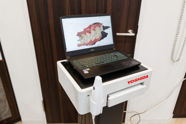 口腔内スキャナー
